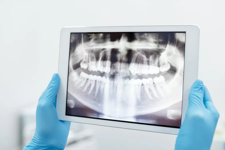 Dentist reviewing dental X-rays on a tablet at Taki Dent Antalya — advanced digital imaging technology used for accurate treatment planning and cost estimation for UK patients