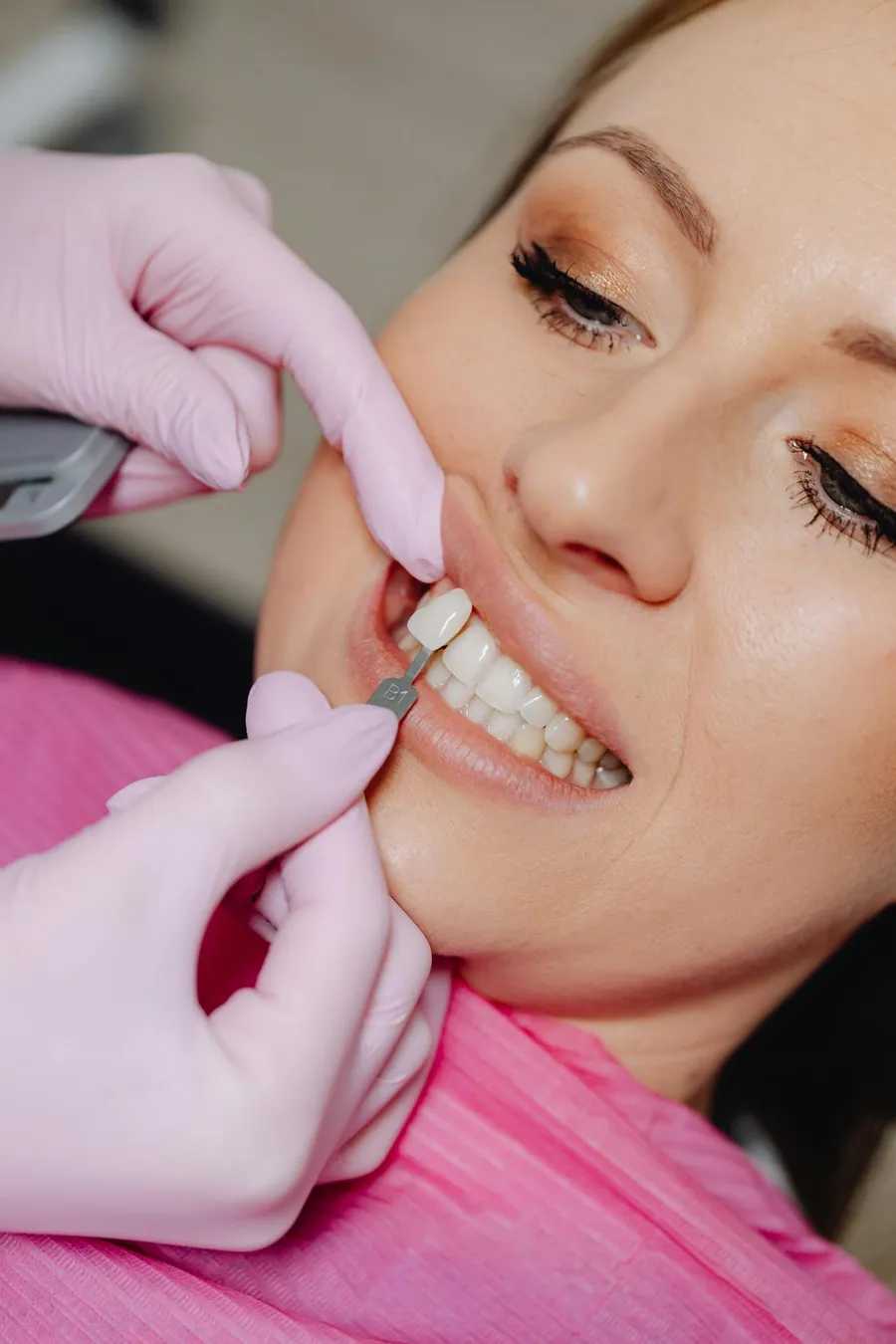 Digital smile design session at Taki Dent Antalya — Dr. Sadık Taki plans a Hollywood Smile transformation with a UK patient