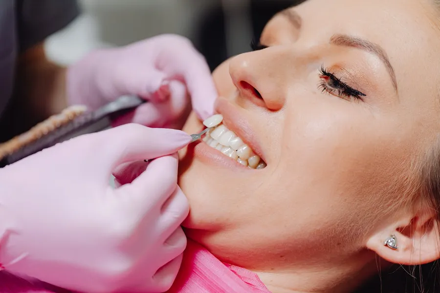 Dentist applying E-max porcelain veneer to a patient's tooth at Taki Dent Antalya — precise bonding technique for a natural finish